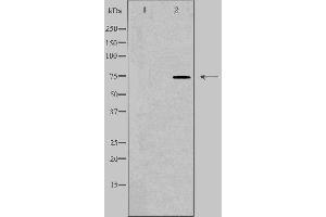 Image no. 2 for anti-Solute Carrier Family 27 (Fatty Acid Transporter), Member 5 (SLC27A5) (Internal Region) antibody (ABIN6258542)