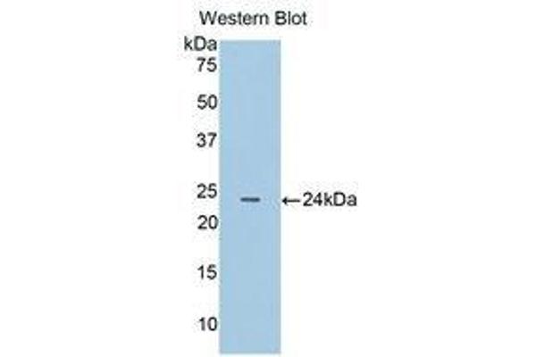 anti-Cathepsin B (CTSB) (AA 129-333) antibody