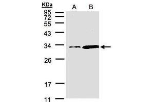 Image no. 1 for anti-Phosphatidylinositol Transfer Protein, alpha (PITPNA) (C-Term) antibody (ABIN2856360)