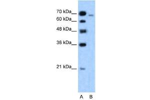 Image no. 2 for anti-Afadin (MLLT4) (N-Term) antibody (ABIN2778340)