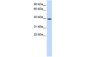 Image no. 1 for anti-Monoacylglycerol O-Acyltransferase 2 (MOGAT2) (Middle Region) antibody (ABIN634991)
