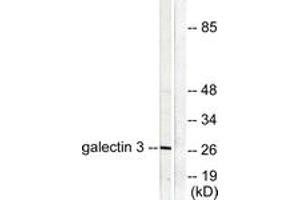 Image no. 1 for anti-Galectin 3 (LGALS3) (AA 141-190) antibody (ABIN1533284)