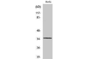 Image no. 1 for anti-Zinc Finger, DHHC-Type Containing 7 (ZDHHC7) (C-Term) antibody (ABIN3184302)