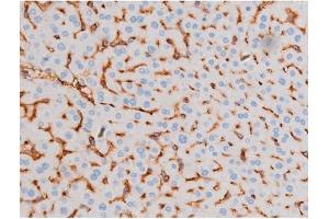Image no. 6 for anti-Insulin Receptor Substrate 1 (IRS1) (pSer639) antibody (ABIN6256390)