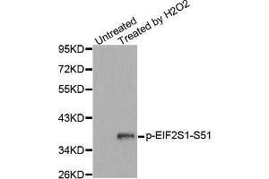 Image no. 3 for anti-Eukaryotic Translation Initiation Factor 2 Subunit 1 (EIF2S1) (pSer51) antibody (ABIN3020190)