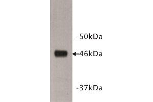 Image no. 1 for anti-Dachsous 1 (DCHS1) antibody (ABIN1854970)