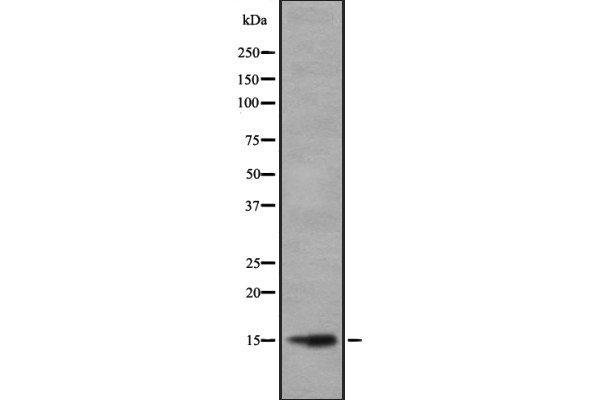 Hemoglobin Alpha 1 + 2 (HBA1,HBA2) (Internal Region) antibody