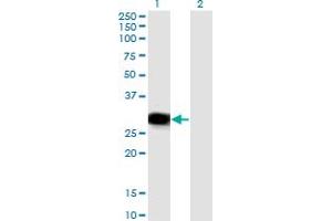 Image no. 1 for anti-RNA Binding Protein with Multiple Splicing (RBPMS) (AA 1-219) antibody (ABIN524417)