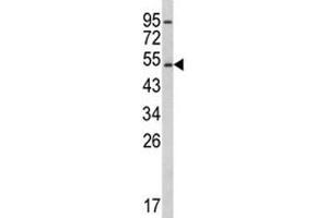 Image no. 4 for anti-Cytochrome P450, Family 2, Subfamily E, Polypeptide 1 (CYP2E1) (AA 402-429) antibody (ABIN3030687)