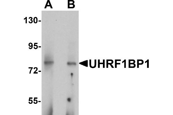 UHRF1BP1 Antikörper  (Middle Region)