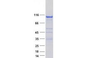 Image no. 1 for PTK2B Protein tyrosine Kinase 2 beta (PTK2B) (Transcript Variant 2) protein (Myc-DYKDDDDK Tag) (ABIN2720715)