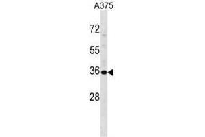 Image no. 1 for anti-Ubiquitin Specific Peptidase 12 (USP12) (AA 221-251), (Middle Region) antibody (ABIN955485)