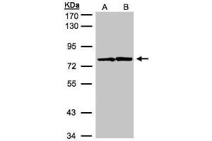 WB Image Sample(30 μg of whole cell lysate) A:Molt-4 , B:Raji, 7.
