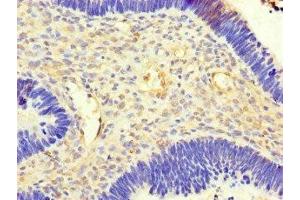 ACSF3 antibody  (AA 365-484)