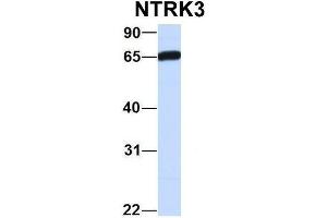 Image no. 5 for anti-Neurotrophic tyrosine Kinase, Receptor, Type 3 (NTRK3) (C-Term) antibody (ABIN2784511)