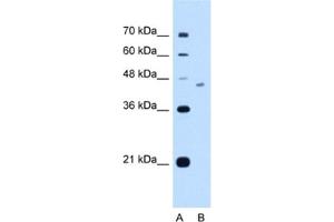 Image no. 1 for anti-FIC Domain Containing (FICD) antibody (ABIN2463017)