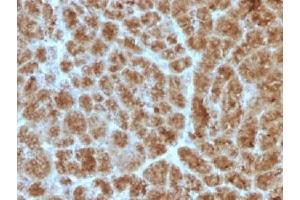 Image no. 3 for anti-Elastase 3B, Pancreatic (ELA3B) (AA 82-238) antibody (ABIN4949400)