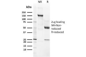 anti-Complement Component (3d/Epstein Barr Virus) Receptor 2 (CR2) (AA 142-240) antibody