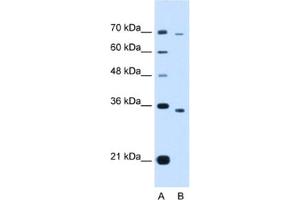 Image no. 1 for anti-PHD Finger Protein 6 (PHF6) antibody (ABIN2463418)