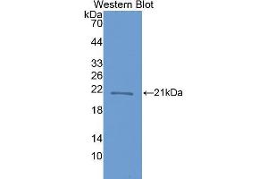 anti-Crystallin, beta B1 (CRYBB1) (AA 17-191) antibody