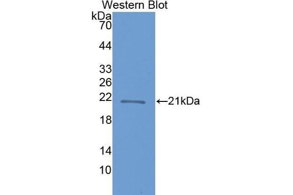CRYBB1 antibody  (AA 17-191)