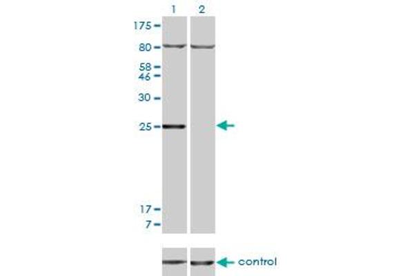 anti-Homeobox B7 (HOXB7) (AA 55-120) antibody