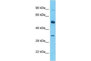 Image no. 1 for anti-ALX Homeobox 3 (ALX3) (C-Term) antibody (ABIN5516465)