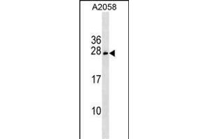 CHCHD6 抗体  (AA 136-165)