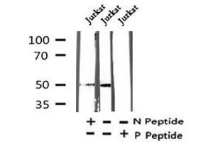 Image no. 6 for anti-Runt-Related Transcription Factor 1 (RUNX1) (pSer397) antibody (ABIN6270096)