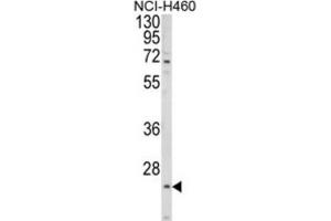 Image no. 2 for anti-Asparagine-Linked Glycosylation 14 Homolog (ALG14) antibody (ABIN3003954)