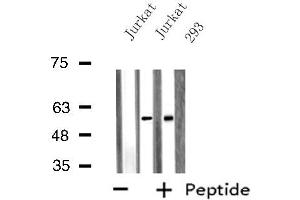 Image no. 1 for anti-Sorting Nexin 1 (SNX1) antibody (ABIN6257498)