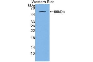 Image no. 1 for anti-Kallikrein 7 (KLK7) (AA 24-255) antibody (ABIN1859556)
