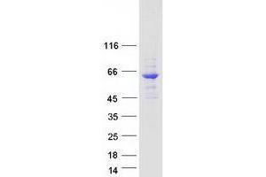 Image no. 1 for TH1-Like (TH1L) (Transcript Variant 1) protein (Myc-DYKDDDDK Tag) (ABIN2733539)