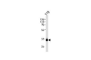 Image no. 1 for anti-Orthodenticle Homeobox 2 (OTX2) (AA 261-289), (C-Term) antibody (ABIN1881611)