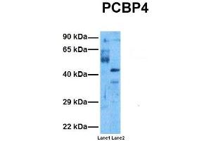 Host:  Rabbit  Target Name:  PCBP4  Sample Tissue:  Human Ovary Tumor, Human 293T  Antibody Dilution:  1.