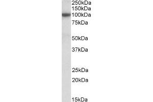 Image no. 1 for anti-ATP-Binding Cassette, Sub-Family C (CFTR/MRP), Member 4 (ABCC4) (AA 70-82) antibody (ABIN5539673)