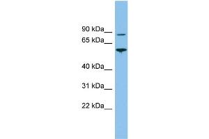Image no. 2 for anti-Vacuolar Protein Sorting 52 Homolog (VPS52) (Middle Region) antibody (ABIN2787317)