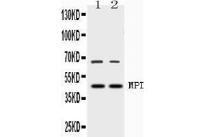 Image no. 1 for anti-Mannose Phosphate Isomerase (MPI) (AA 2-99) antibody (ABIN4886672)