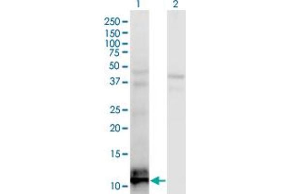 anti-TGFB1-Induced Anti-Apoptotic Factor 1 (TIAF1) (AA 1-115) antibody