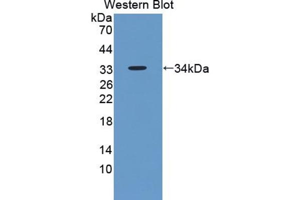Endonuclease G 抗体  (AA 16-290)