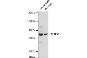 CCDC11 antibody  (AA 1-300)