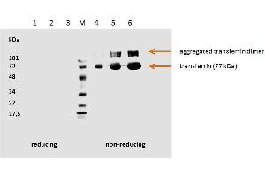 Image no. 2 for anti-Transferrin (TF) antibody (ABIN2749040)