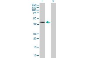 Image no. 1 for anti-Transcription Factor B1, Mitochondrial (TFB1M) (AA 1-346) antibody (ABIN526459)