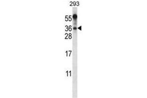 BEND6 Antibody (C-term) western blot analysis in 293 cell line lysates (35µg/lane).
