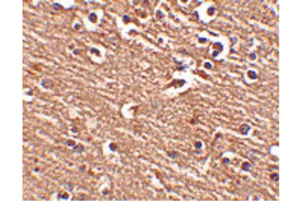 SLITRK1 anticorps  (C-Term)