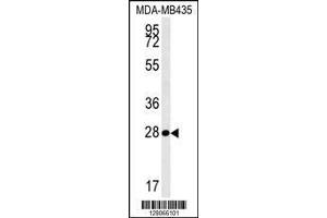 Image no. 1 for anti-Mitochondrial rRNA Methyltransferase 1 Homolog (MRM1) (AA 80-109), (N-Term) antibody (ABIN654341)