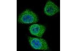 Image no. 2 for anti-Gastric Intrinsic Factor (Vitamin B Synthesis) (GIF) (AA 188-218), (Middle Region) antibody (ABIN952930)