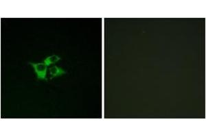 Image no. 2 for anti-Endothelin Receptor Type A (EDNRA) (AA 378-427) antibody (ABIN1535599)