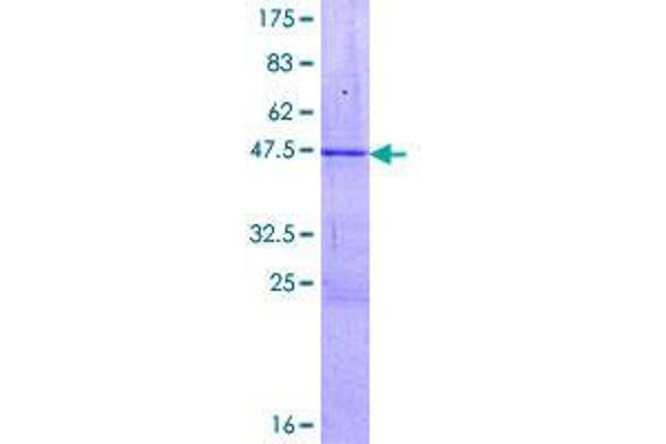 ZSCAN1 Protein (AA 1-178) (GST tag)