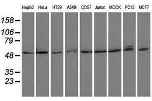 Image no. 1 for anti-Proteasome (Prosome, Macropain) 26S Subunit, ATPase, 3 (PSMC3) antibody (ABIN1501335)